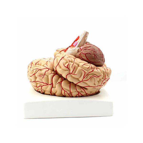 Brain with Arteries Model, 9 Parts
