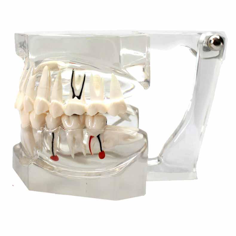 Clear Human Jaw with Teeth Model